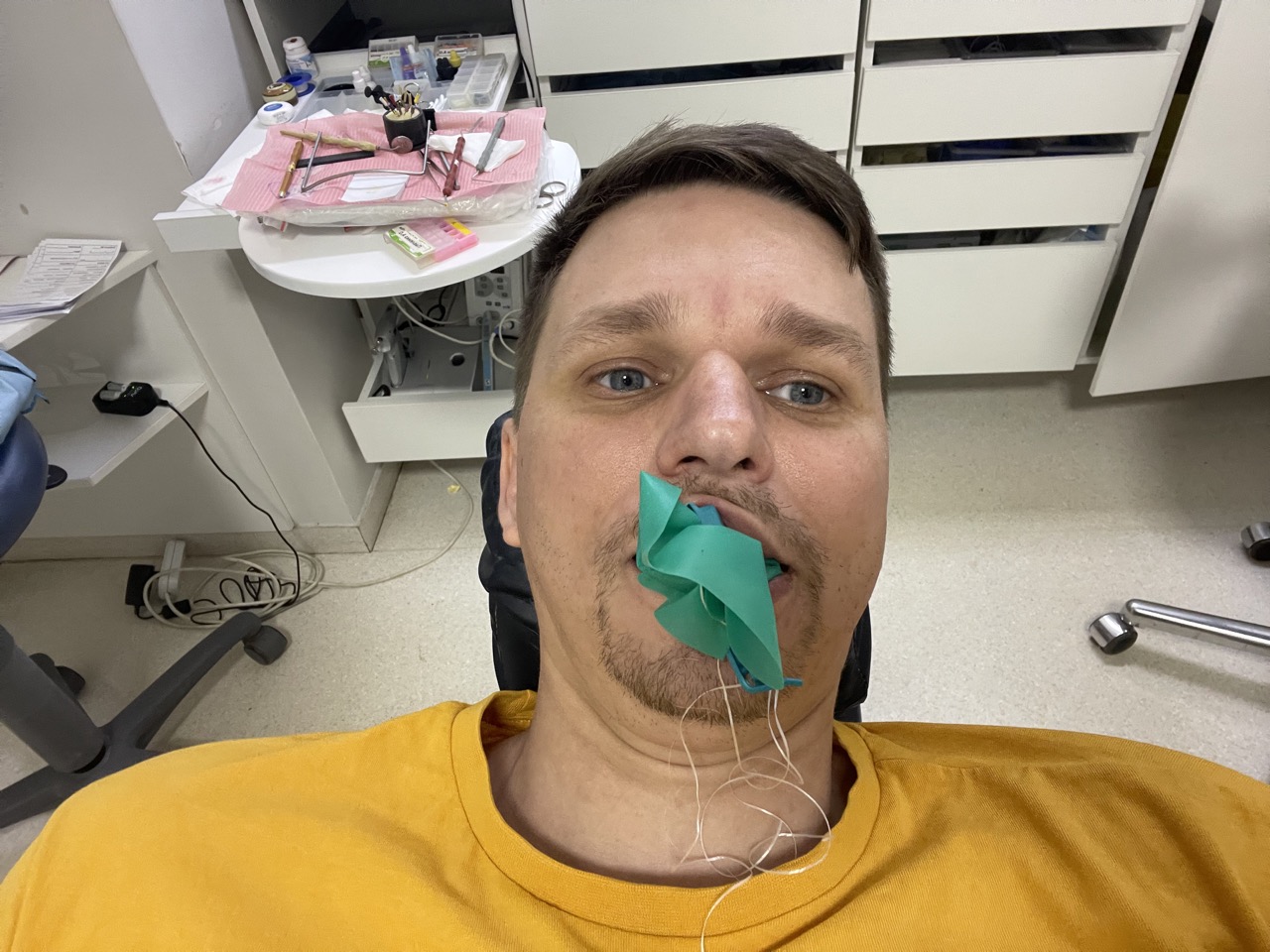 На фото автор блога на последнем лечении зубов.